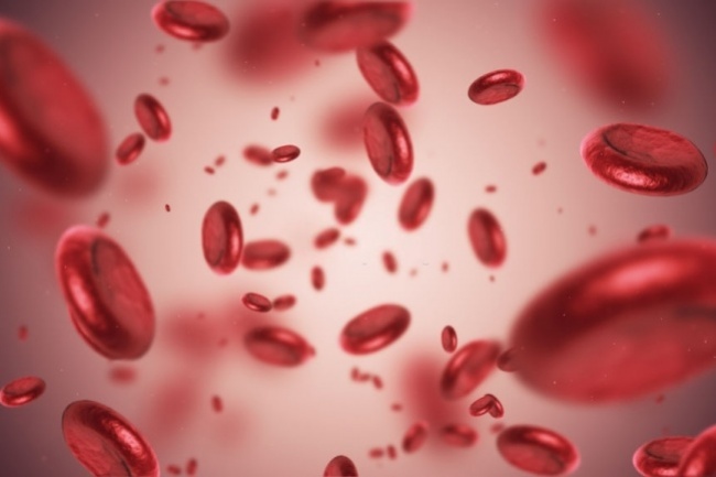 Anemia